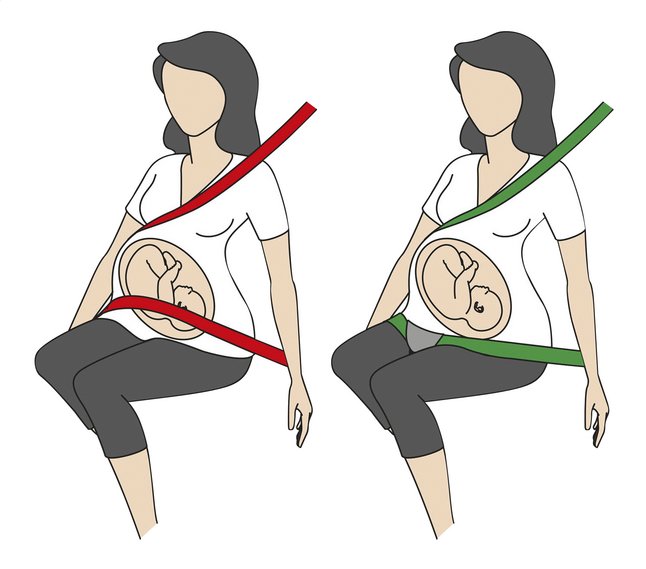 Guide Ceinture de sécurité grossesse